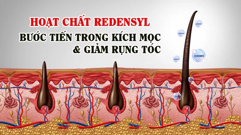 Tinh chất kelina - giải mã hiệu quả ngăn gãy rụng dưỡng mềm mượt đột phá - 3