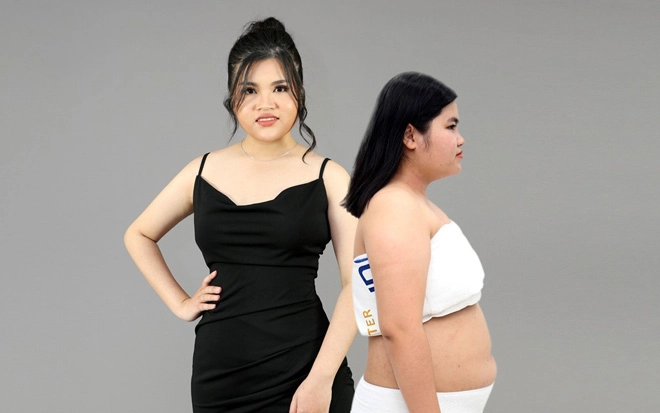 Tmv ngọc dung tái xuất hai công nghệ kỉ lục về số ca trẻ hóa và giảm mỡ - 1
