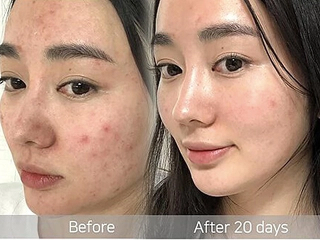 Tóc tiên và quỳnh anh shyn liên tiếp gặp tai nạn về chăm sóc da - 11