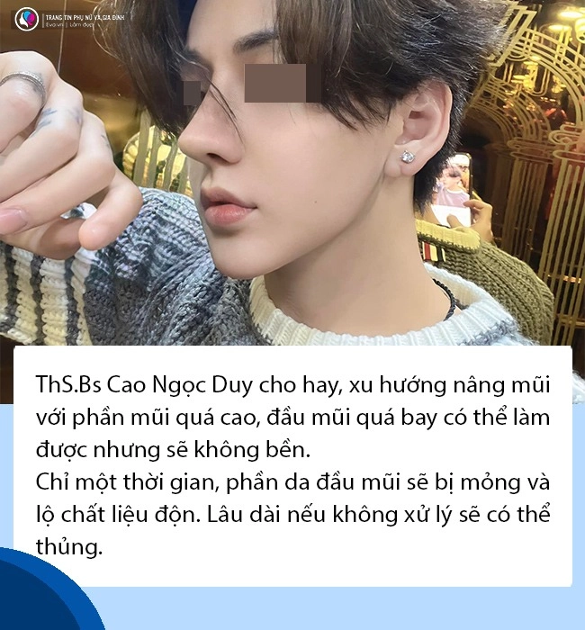Tranh cãi nhan sắc của nam diễn viên hậu dao kéo từ mặt rắn sang góc cạnh soái ca - 16