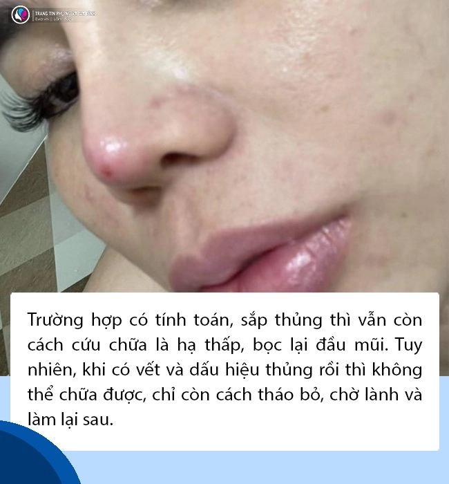 Tranh cãi nhan sắc của nam diễn viên hậu dao kéo từ mặt rắn sang góc cạnh soái ca - 17