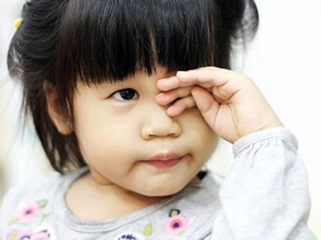 Trẻ bị đau mắt cha mẹ không nên chủ quan - 4