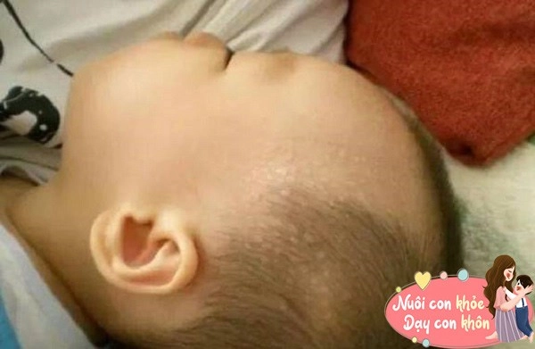 Trẻ đổ mồ hôi khi ngủ có phải yếu không bs nhi cần bổ sung ngay chất này - 3