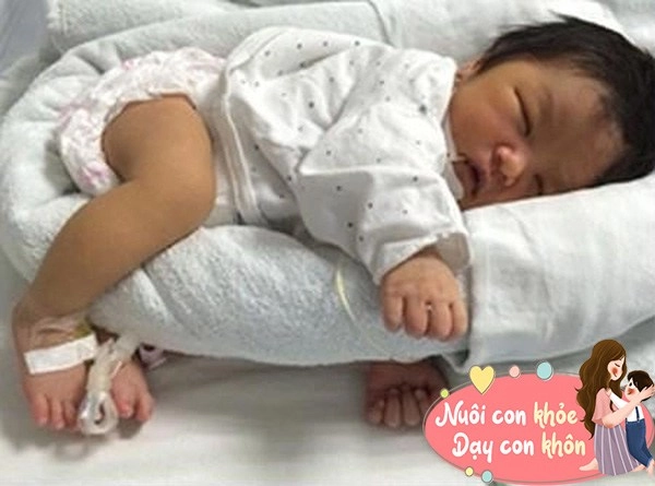 Trẻ ngủ tư thế này dễ làm đầu biến dạng mẹ phải biết để điều chỉnh cho bé - 5