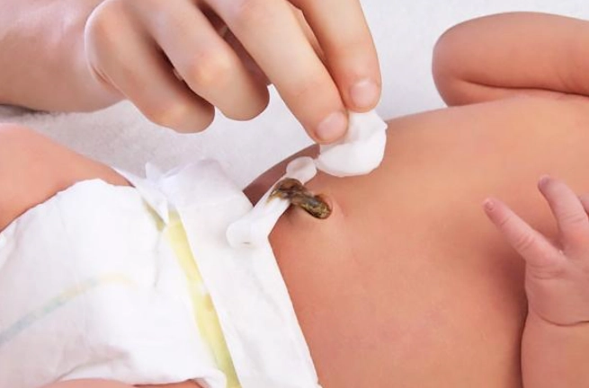 Trẻ sơ sinh bao lâu thì rụng rốn và cách vệ sinh rốn cho bé - 4