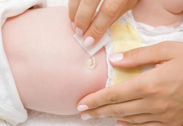 Trẻ sơ sinh bao lâu thì rụng rốn và cách vệ sinh rốn cho bé - 5