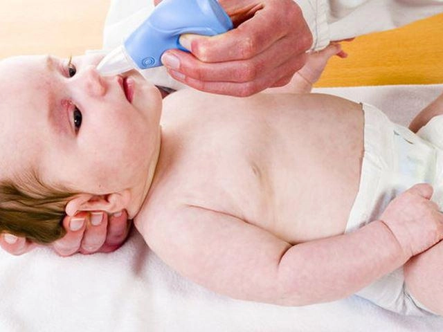 Trẻ sơ sinh bị nghẹt mũi nhưng không chảy nước mũi là bị sao xử lý thế nào - 3