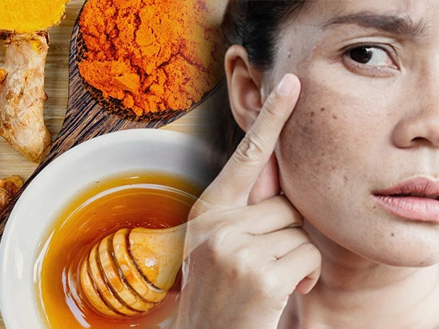 Trị mụn bằng mật ong chiêu làm đẹp bổ-rẻ đắp đến đâu da phục hồi và láng mịn đến đó - 8