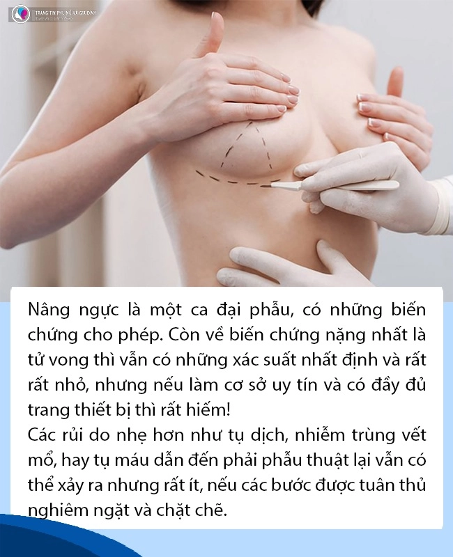 Tsbs nguyễn hữu quang trường hợp sốc phản vệ khi nâng ngực là điều bất khả kháng - 3