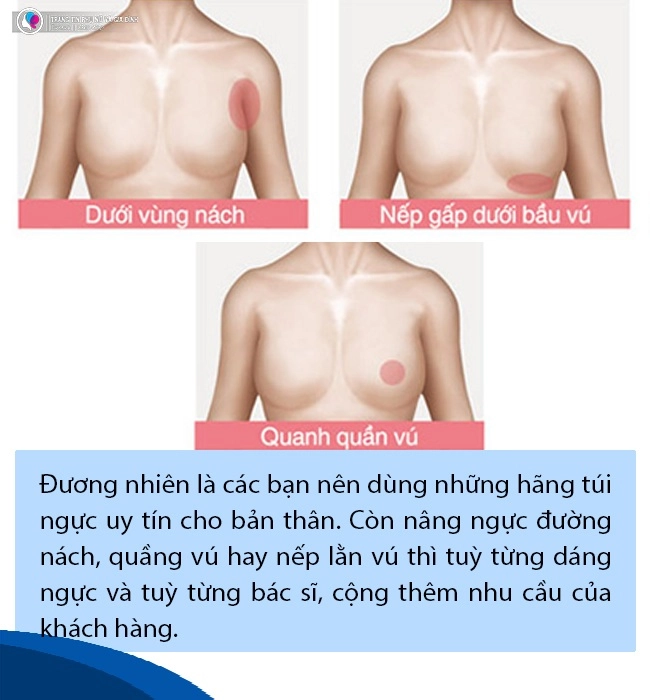 Tsbs nguyễn hữu quang trường hợp sốc phản vệ khi nâng ngực là điều bất khả kháng - 8