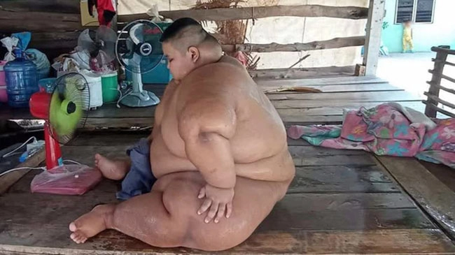 Từ nhỏ bị ép ăn cho chóng lớn bé 13 tuổi nặng 200kg mẹ mất giờ không ai nuôi - 1