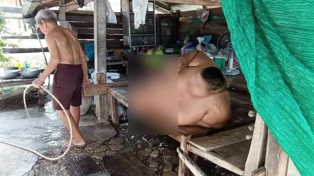 Từ nhỏ bị ép ăn cho chóng lớn bé 13 tuổi nặng 200kg mẹ mất giờ không ai nuôi - 2