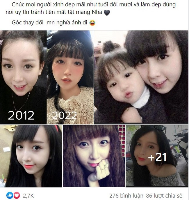 U35 2 con từ vịt hoá thiên nga nghìn like nhờ trải qua 8 biện pháp trùng tu - 1