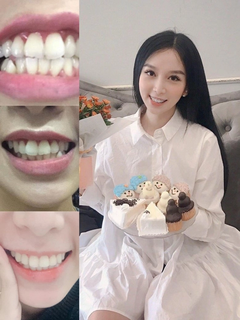 U35 2 con từ vịt hoá thiên nga nghìn like nhờ trải qua 8 biện pháp trùng tu - 8