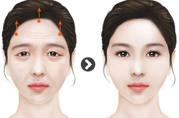 U50 diễn vai thiếu nữ bị chê thậm tệ châu tấn từng muốn tìm cách để trẻ hơn - 9