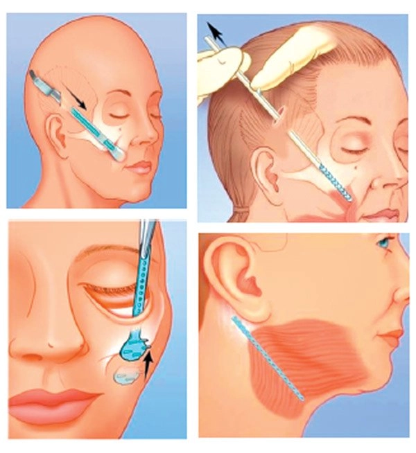 U50 diễn vai thiếu nữ bị chê thậm tệ châu tấn từng muốn tìm cách để trẻ hơn - 10