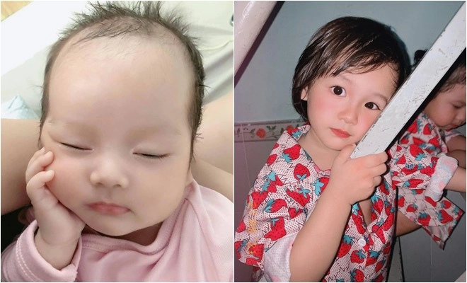 Uống thuốc tránh thai với bạn trai 9x sinh con đầu hói mắt hí 2 năm sau ai cũng khen - 12
