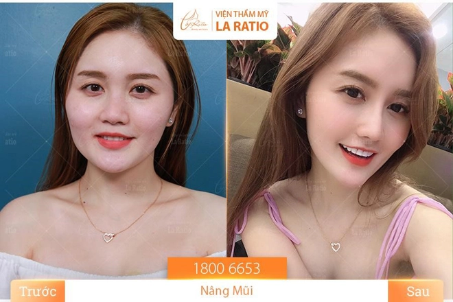Viện thẩm mỹ la ratio - địa chỉ an toàn cho các tín đồ làm đẹp - 4