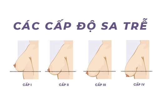 Vòng 1 xuống sắc sau sinh mỹ nhân việt đổ tiền sửa sang nâng cấp đẹp như thời còn son - 11