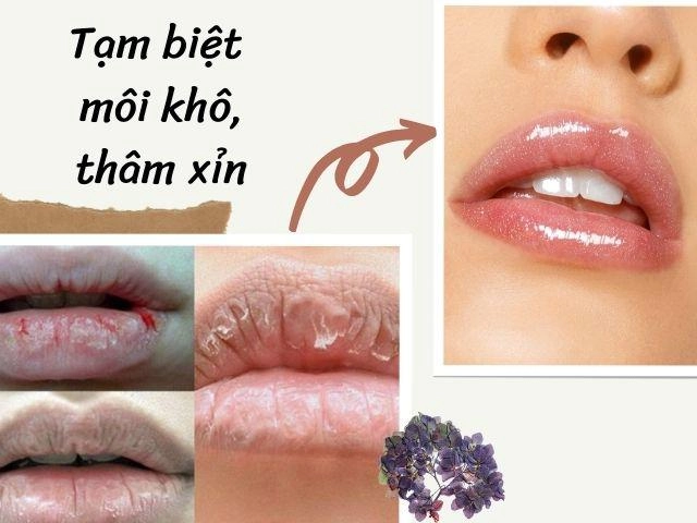 Vừa làm đẹp da vừa dưỡng môi căng bóng nhờ các nguyên liệu rẻ bèo mà ai cũng biết - 6