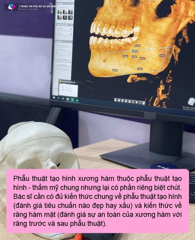 Vừa thực hiện combo hạ gò má gọt hàm trượt cằm cô nàng đã ngồi dậy chạy deadline - 4