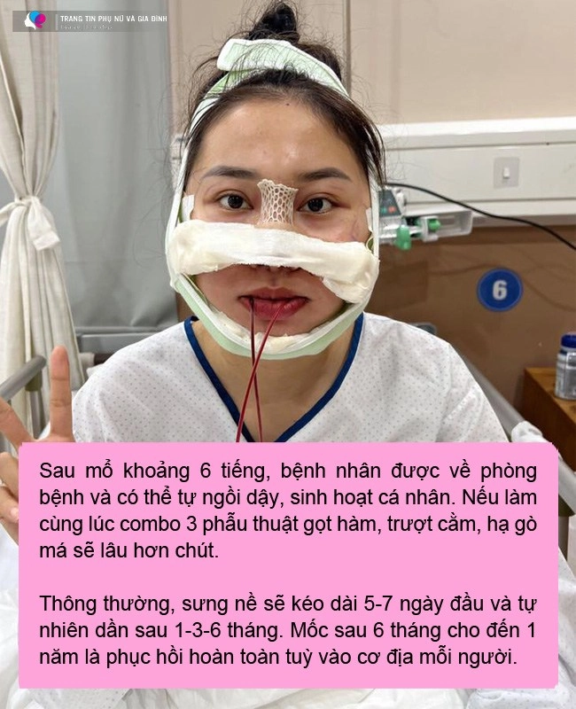 Vừa thực hiện combo hạ gò má gọt hàm trượt cằm cô nàng đã ngồi dậy chạy deadline - 8