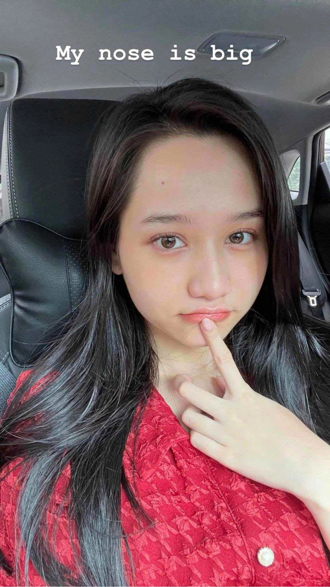 Xinh đẹp như trúc anh mắt biếc cũng tự ti về 1 bộ phận trên gương mặt - 1