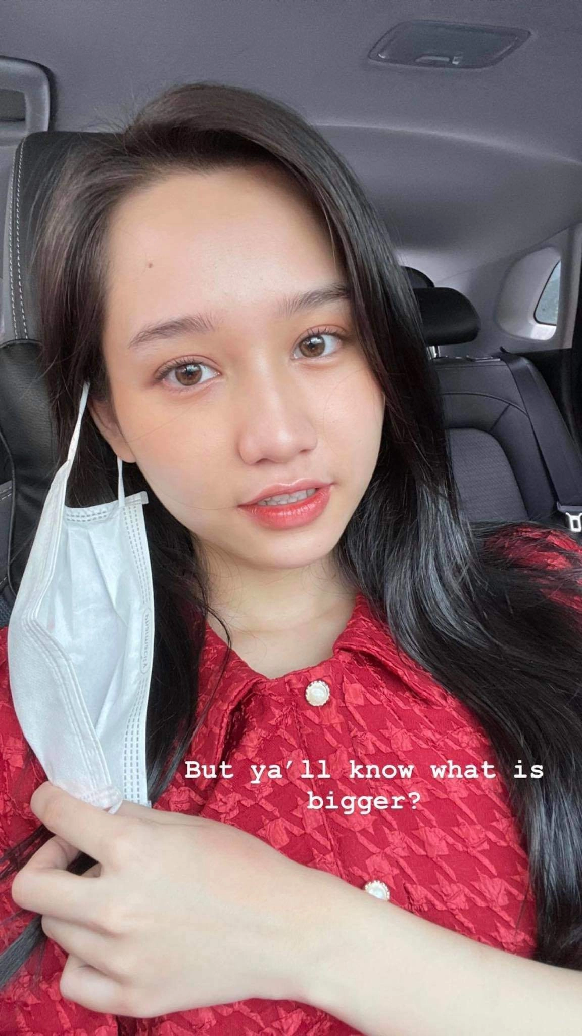 Xinh đẹp như trúc anh mắt biếc cũng tự ti về 1 bộ phận trên gương mặt - 2