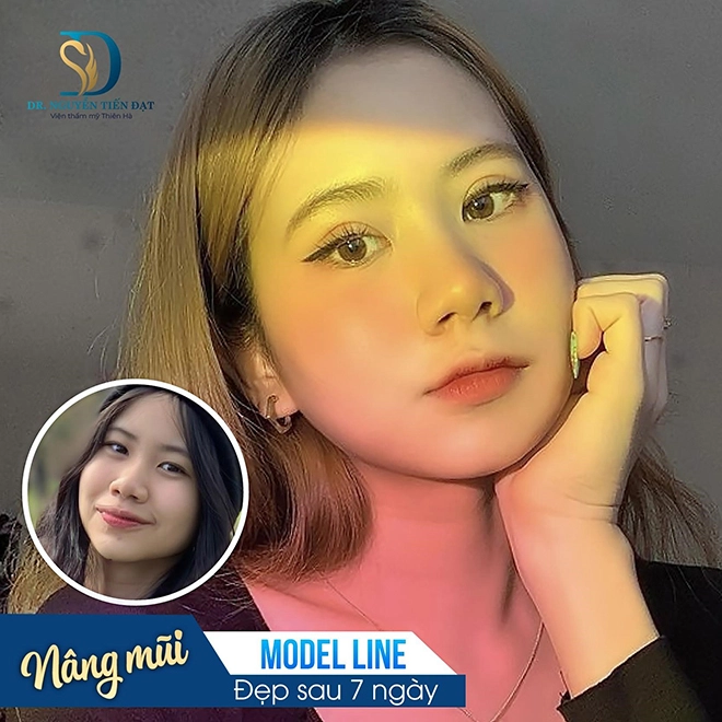 Xu thế ứng dụng công nghệ 40 trong phẫu thuật thẩm mỹ - 1