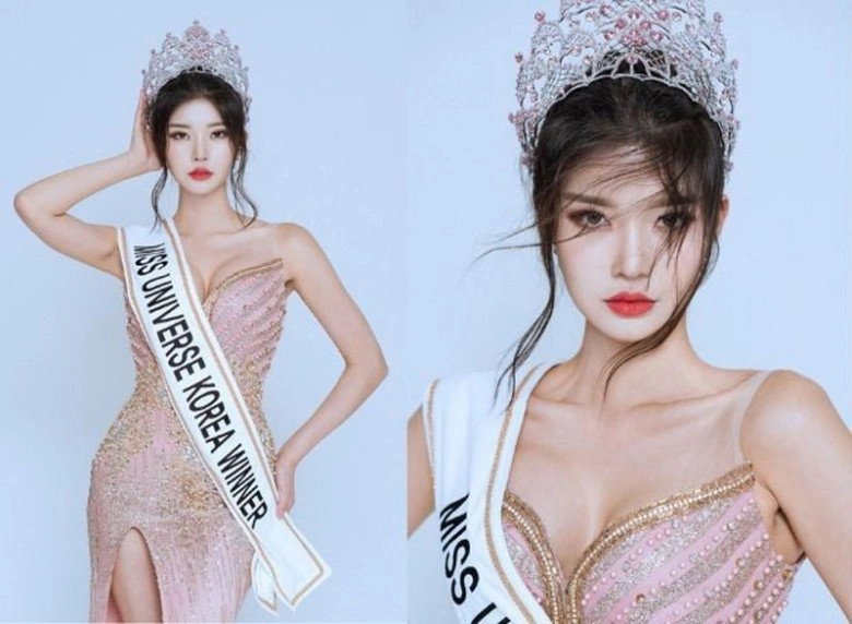 Xuất hiện đối thủ mạnh của ngọc châu tại miss universe cao 1m83 da trắng dáng chuẩn là chân dài quốc tế - 1