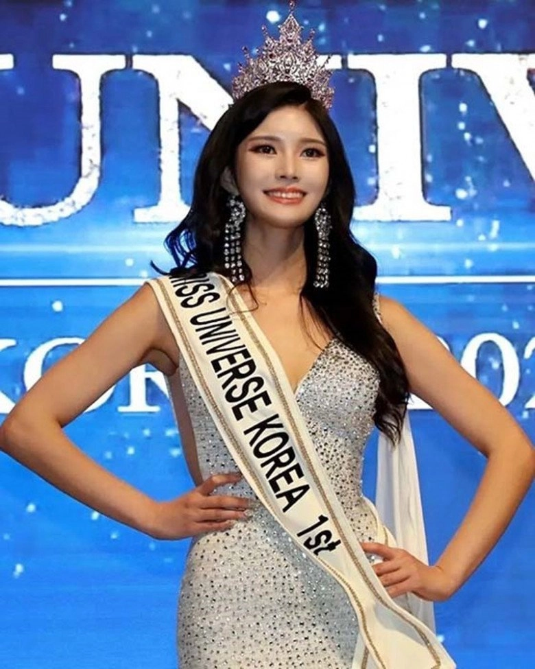 Xuất hiện đối thủ mạnh của ngọc châu tại miss universe cao 1m83 da trắng dáng chuẩn là chân dài quốc tế - 2