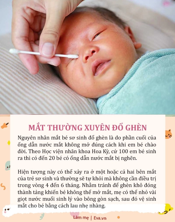 7 biểu hiện bất thường ở bé sơ sinh nhưng mẹ yên tâm không phải bệnh - 6