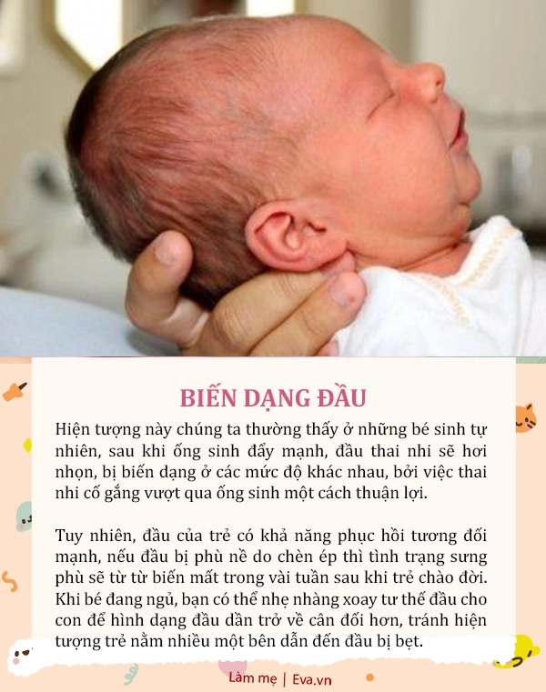 7 biểu hiện bất thường ở bé sơ sinh nhưng mẹ yên tâm không phải bệnh - 7