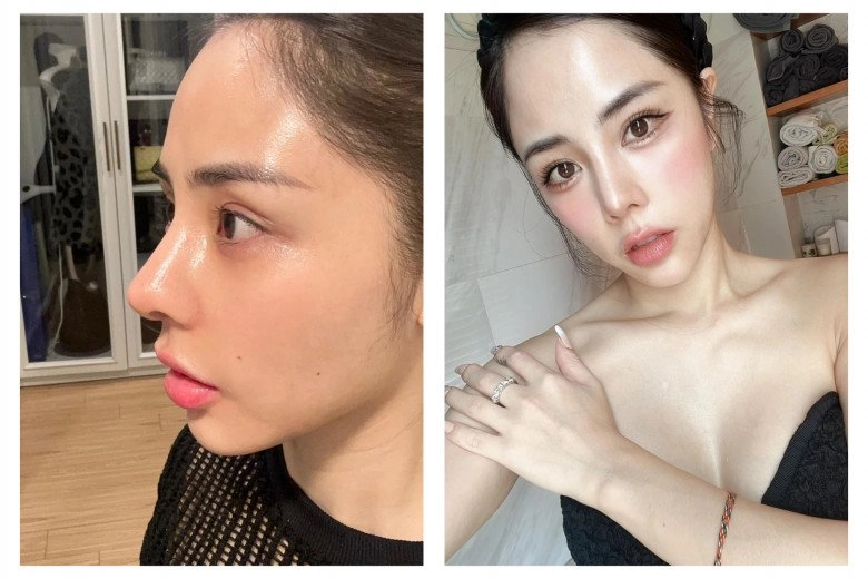 Chuyện ngược đời có 2 bộ phận cơ thể chị em nào cũng muốn thêm mỹ nhân việt lại đi tháo ra bớt - 15