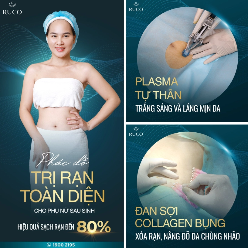 Đan chỉ collagen đa tầng kết hợp plasma tự thân - đột phá trong điều trị xóa rạn bụng - 5