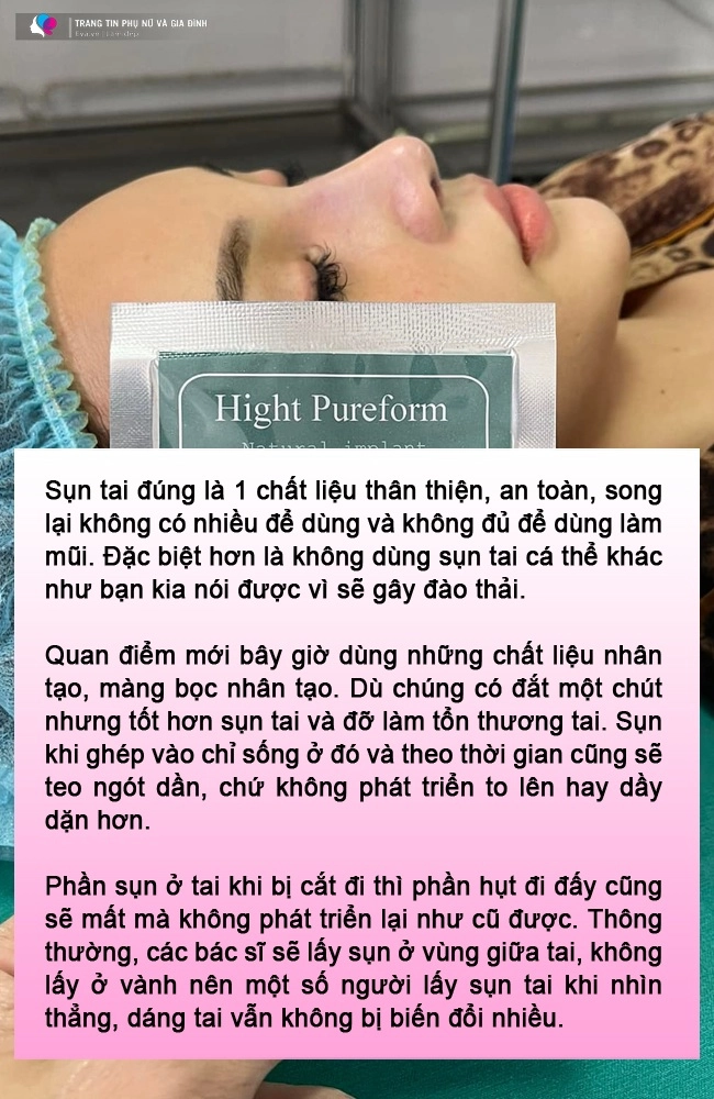 Đòi lấy sụn tai bạn trai nâng mũi gái xinh làm cõi mạng lao đao bác sĩ trả lời thế nào - 6