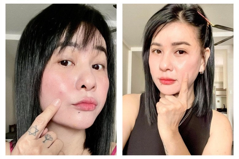 Hậu công khai ảnh cưới cát phượng tái xuất với gương mặt đơ cứng môi tều dân mạng đoán có tiêm chích nhẹ - 7