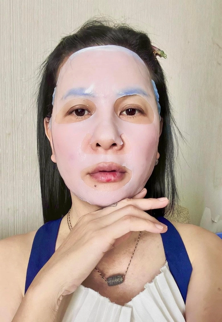 Hậu công khai ảnh cưới cát phượng tái xuất với gương mặt đơ cứng môi tều dân mạng đoán có tiêm chích nhẹ - 8
