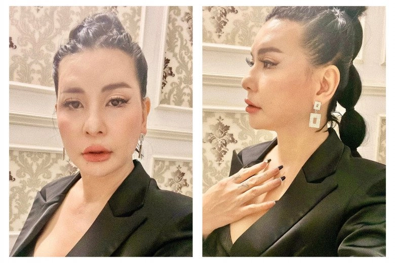 Hậu công khai ảnh cưới cát phượng tái xuất với gương mặt đơ cứng môi tều dân mạng đoán có tiêm chích nhẹ - 11