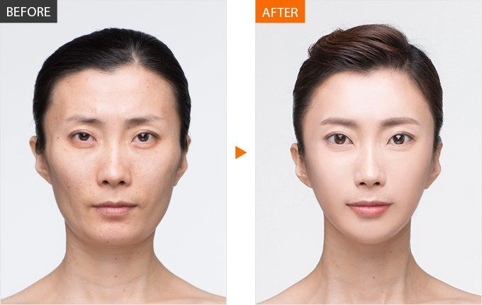 Hậu công khai ảnh cưới cát phượng tái xuất với gương mặt đơ cứng môi tều dân mạng đoán có tiêm chích nhẹ - 14