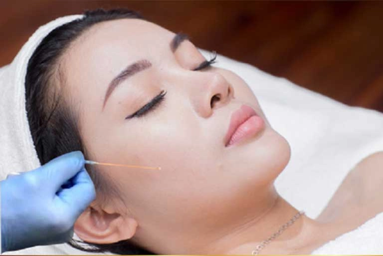 Hậu công khai ảnh cưới cát phượng tái xuất với gương mặt đơ cứng môi tều dân mạng đoán có tiêm chích nhẹ - 17