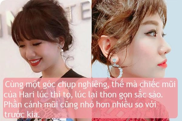 Ít ai biết điểm chung nhan sắc của vợ 3 danh hài hot nhất showbiz việt - 4