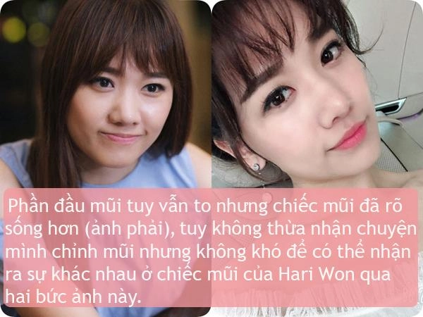 Ít ai biết điểm chung nhan sắc của vợ 3 danh hài hot nhất showbiz việt - 5