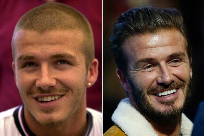 Là soái ca sân cỏ cristiano ronaldo - david beckham cũng sửa sang vung gần nửa tỷ để thăng hạng nhan sắc - 5