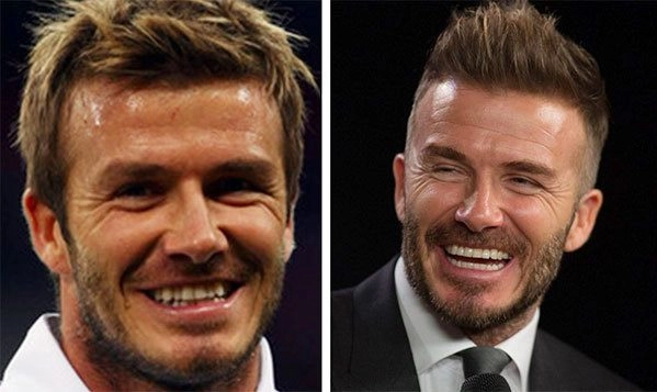 Là soái ca sân cỏ cristiano ronaldo - david beckham cũng sửa sang vung gần nửa tỷ để thăng hạng nhan sắc - 6