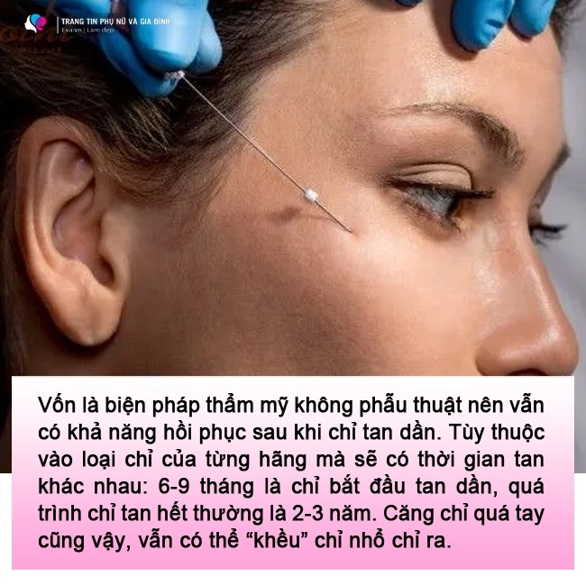 lạnh gáy những pha cấy chỉ căng da của chị em trung niên đẹp chưa thấy ngắm đã xót - 11