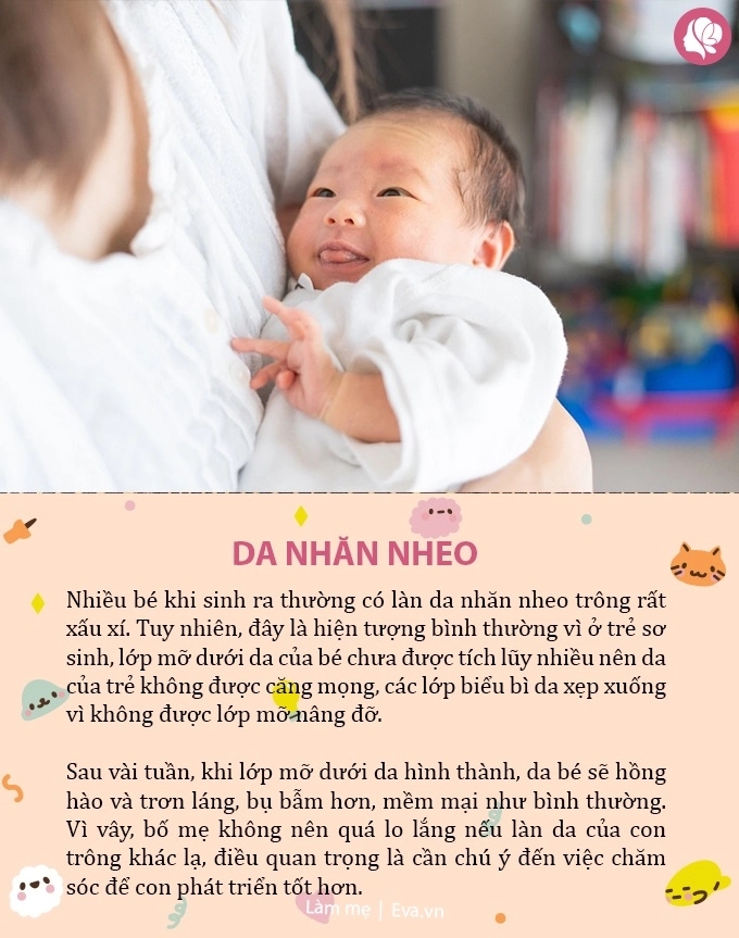 Trẻ sơ sinh có những đặc điểm này tưởng chừng xấu xí nhưng 90 lớn lên sẽ rất xinh đẹp - 3