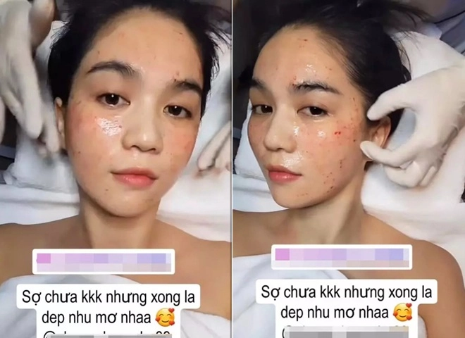 Từng tự tin có gương mặt mang vẻ đẹp quê trẻ lâu ngọc trinh nay thừa nhận phải đi chích nhẹ khi cần - 6