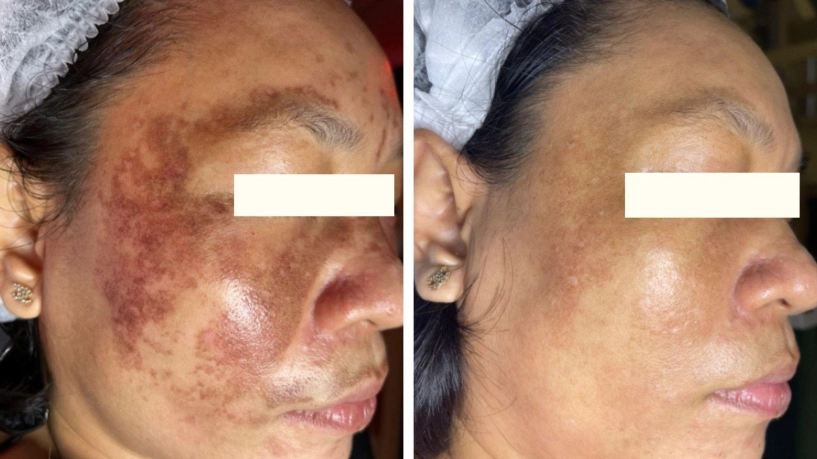 Drh clinic - khẳng định vị thế trong ngành làm đẹp - 2