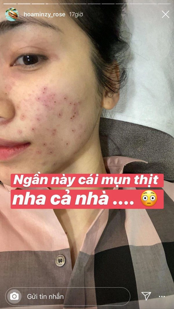 Hòa minzy skincare chưa đến 10 phút mỗi ngày mà da đẹp cỡ này chị em bận rộn vào học hỏi ngay - 9